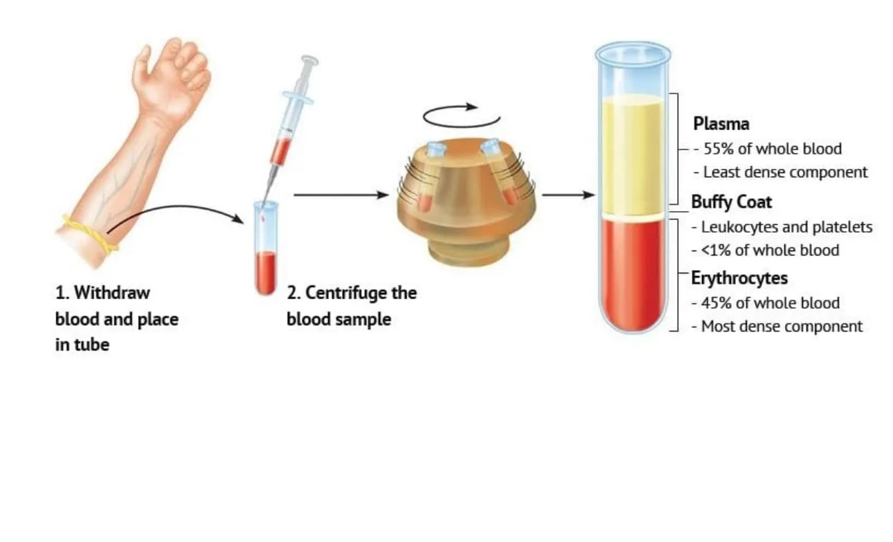 PRP and PRF Therapy at My BioHealth